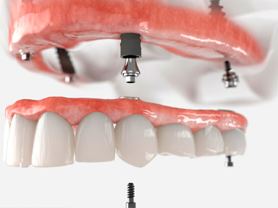 Tratamentos Odontológicos em Guarulhos