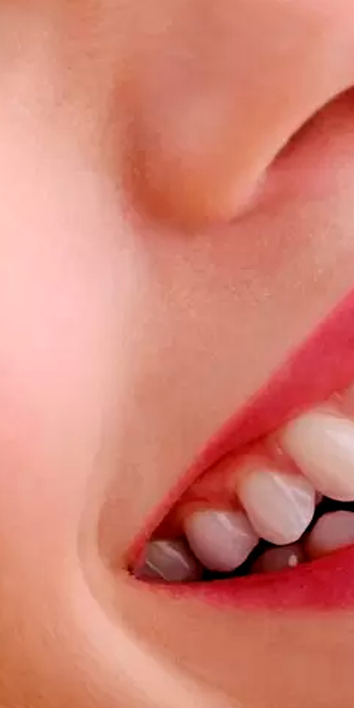 Periodontia - Guarulhos